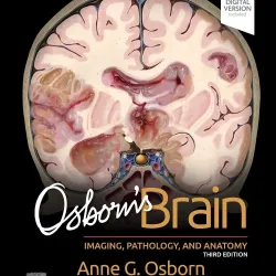 Osborn's Brain - 3E