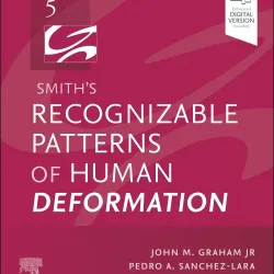 Smith's Recognizable Patterns of Human Deformation:  5E