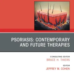 Psoriasis: Contemporary and Future Therapies, An Issue of Dermatologic Clinics-1E