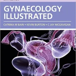 Gynaecology Illustrated 6/e