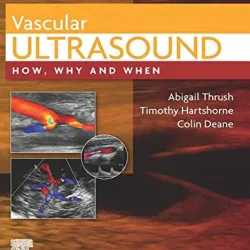 Vascular Ultrasound: How, Why and When - 4E