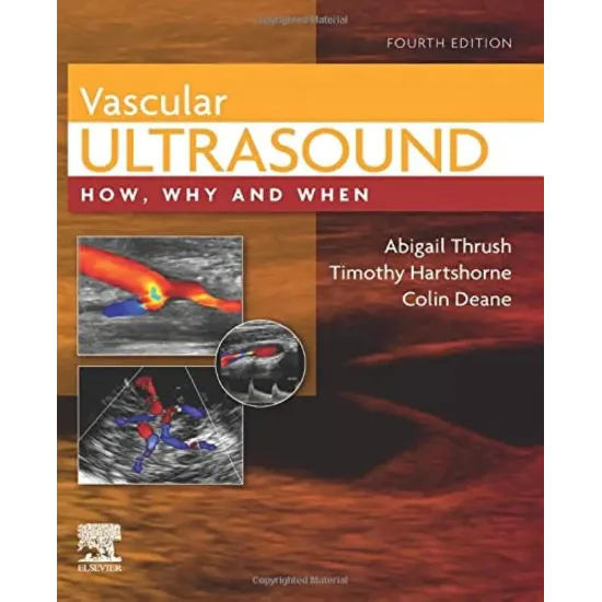 Vascular Ultrasound: How, Why and When - 4E