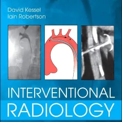 Interventional Radiology: A Survival Guide -4E