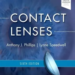 Contact Lenses - 6E