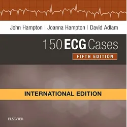 150 ECG Cases(IE) -5E 