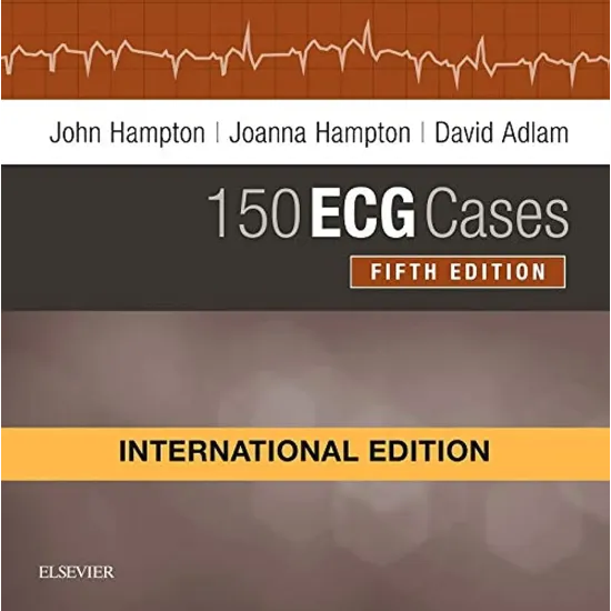 150 ECG Cases(IE) -5E 