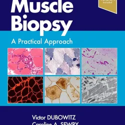 Muscle Biopsy-5E