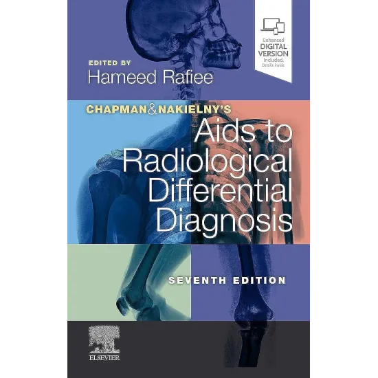 Chapman & Nakielny's Aids to Radiological Differential Diagnosis - 7E