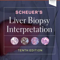 Scheuer's Liver Biopsy Interpretation -10E 