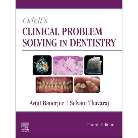 Odell's Clinical Problem Solving in Dentistry -4ED