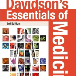 Davidson's Essentials of Medicine-3E