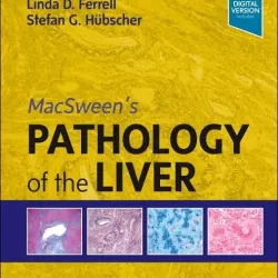 MacSween's Pathology of the Liver-8E