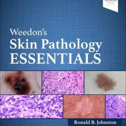 Weedon's Skin Pathology Essentials-3E