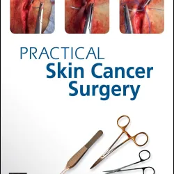 Practical Skin Cancer Surgery-1E