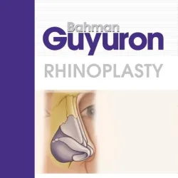 Rhinoplasty - 1E