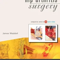 Operative Techniques- Hip Arthritis Surgery- Book, Website& DVD-1E