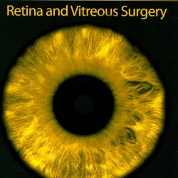 Surgical Techniques in Ophthalmology Series: Retina and Vitreous Surgery: Text with DVD - 1E