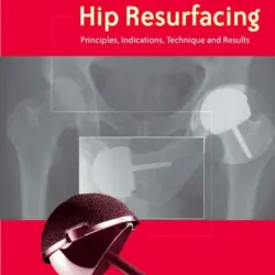 Hip Resurfacing