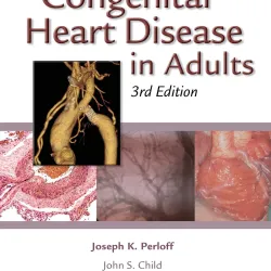 Cogenital Heart Disease/ Adults 3E