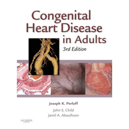 Cogenital Heart Disease/ Adults 3E