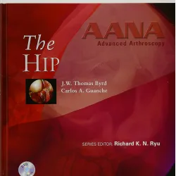 Advanced Arthoscopy: The Hip