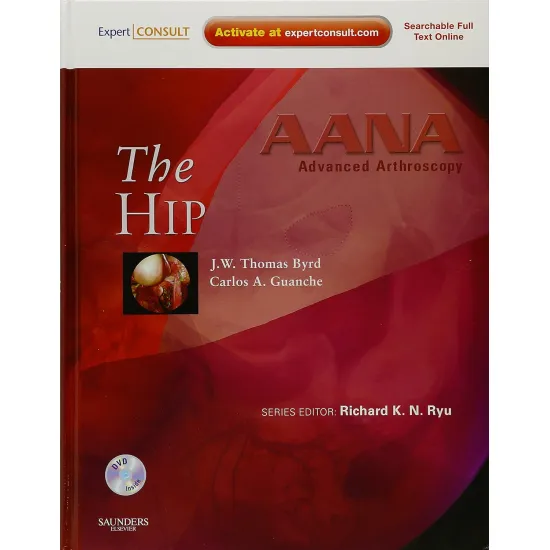 Advanced Arthoscopy: The Hip