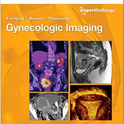 Gynecologic Imaging- Expert Radiology Series -1E