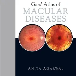 Stereoscopic Atlas/Macular Dis 5/e (2vol)