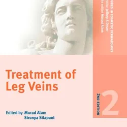 PCDS: Treat of Leg Veins 2/e