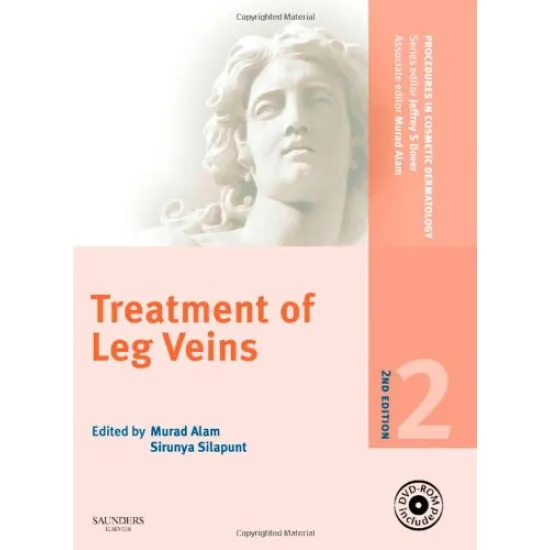 PCDS: Treat of Leg Veins 2/e