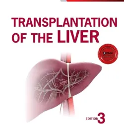 Transplantation of the Liver-3E