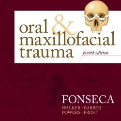 Oral & Maxillofacial Trauma - 4E