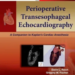 Perioperative Transesophageal Echocardiography