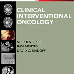 Clinical Interventional Oncology