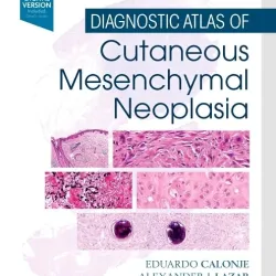 Diagnostic Atlas of Cutaneous Mesenchymal Neoplasia -1E