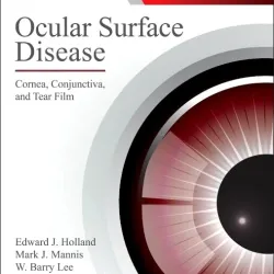 Ocular Surface Disease: Cornea, Conjunctiva and Tear Film - 1E