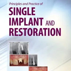 Princ & Pract of Single Implant & Restorations - 1E