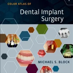 Color Atlas of Dental Implant Surgery - 4E