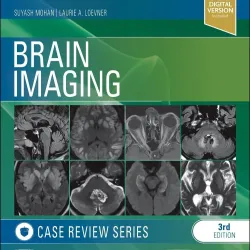 Brain Imaging: Case Review Series-3E