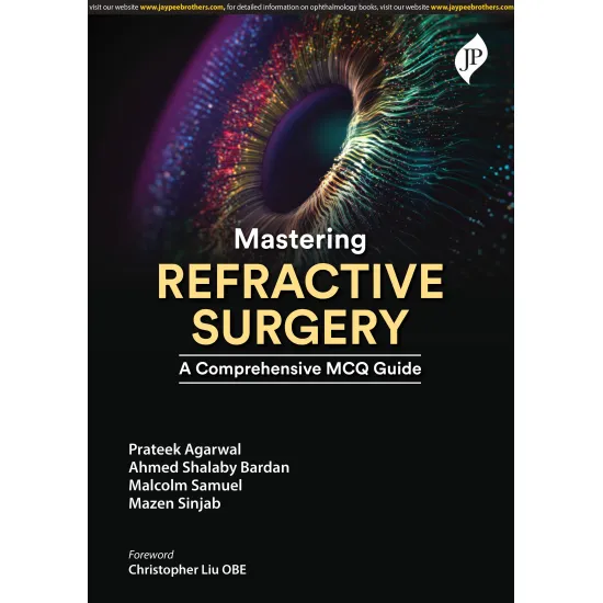 Mastering Refractive Surgery A Comprehensive Mcq Guide