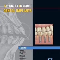 Specialty Imaging: Dental Implants