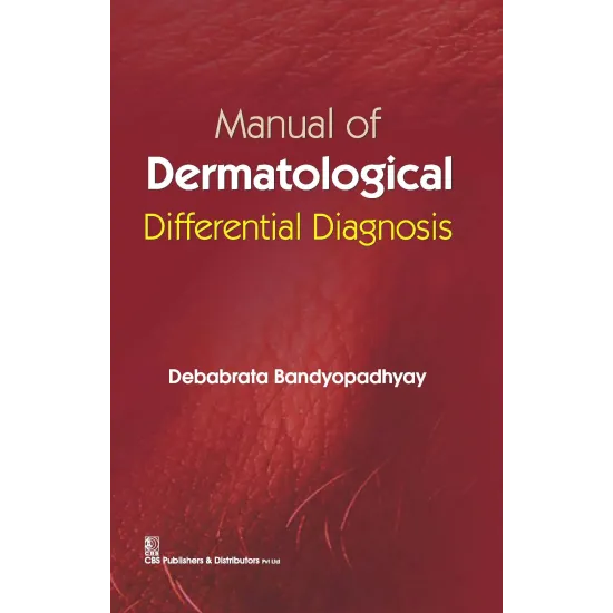 Manual Of Dermatological Differential Diagnosis (Pb 2016) 