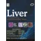 Liver: A Complete Book on Hepato-Pancreato-Biliary Diseases