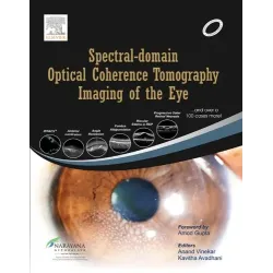 Spectral Domain Optical Coherence Tomography Imaging of the Eye