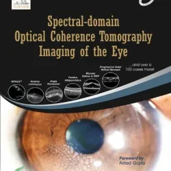 Spectral Domain Optical Coherence Tomography Imaging of the Eye