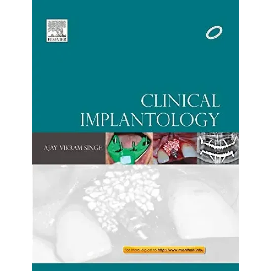 Clinical Implantology IE