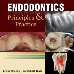 Endodontics: Principles and Practice