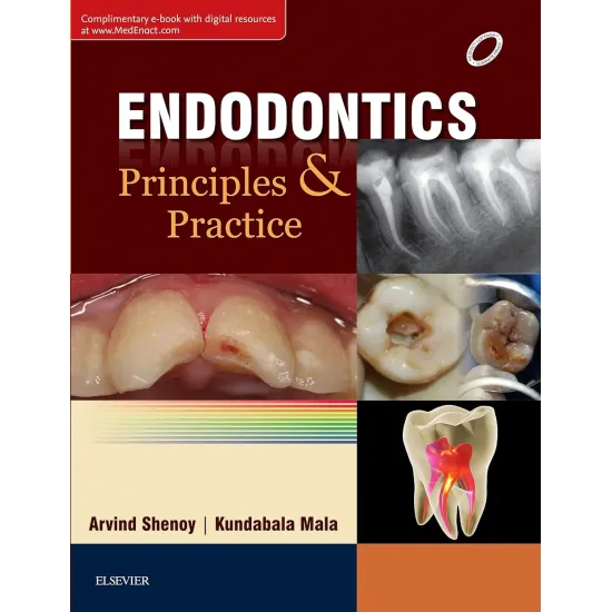 Endodontics: Principles and Practice