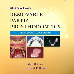 McCracken'S Removable Partial Prosthodontics - 1E