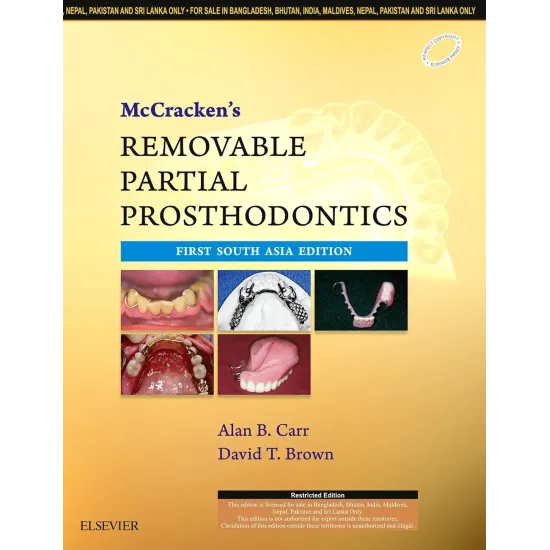 McCracken'S Removable Partial Prosthodontics - 1E